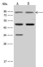 ZW10 Antibody in Western Blot (WB)