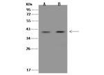 ZWINT Polyclonal Antibody