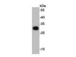 HSV tag Polyclonal Antibody