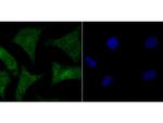 HMGB2 Polyclonal Antibody