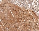 LGI1 Polyclonal Antibody