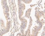 CPEB1 Polyclonal Antibody