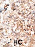 Osteocalcin Polyclonal Antibody