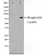 Phospho-FER (Tyr402) Antibody in Western Blot (WB)