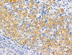 Dysferlin Antibody in Immunohistochemistry (Paraffin) (IHC (P))