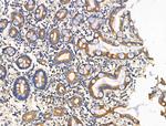 ITGB5 Polyclonal Antibody