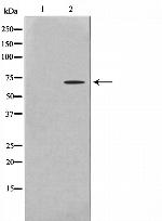 PHF1 Antibody in Western Blot (WB)