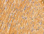 LZK Antibody in Immunohistochemistry (Paraffin) (IHC (P))