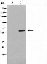 Lass4 Antibody in Western Blot (WB)
