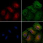 ILKAP Polyclonal Antibody