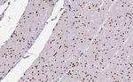 ILKAP Antibody in Immunohistochemistry (Paraffin) (IHC (P))