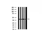ILKAP Antibody in Western Blot (WB)