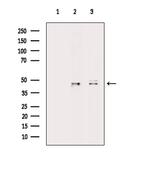 ILKAP Antibody in Western Blot (WB)