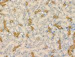 NAA15 Polyclonal Antibody