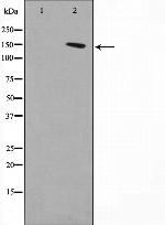 DGKD Polyclonal Antibody