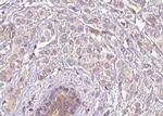 Phospho-MCK10 (Tyr513) Antibody in Immunohistochemistry (Paraffin) (IHC (P))