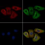 Phospho-ErbB2 (HER-2) (Tyr1221, Tyr1222) Antibody in Immunocytochemistry (ICC/IF)