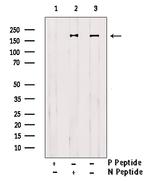 Phospho-ErbB2 (HER-2) (Tyr1221, Tyr1222) Antibody in Western Blot (WB)