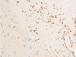 Phospho-PDPK1 (Ser241) Antibody in Immunohistochemistry (Paraffin) (IHC (P))