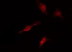 Phospho-TAK1 (Thr187) Antibody in Immunocytochemistry (ICC/IF)