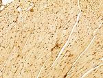 Phospho-FOXO3A (Ser253) Antibody in Immunohistochemistry (Paraffin) (IHC (P))