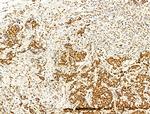 Phospho-FOXO3A (Ser253) Antibody in Immunohistochemistry (Paraffin) (IHC (P))