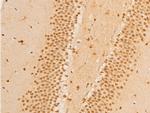 Phospho-FOXO3A (Ser253) Antibody in Immunohistochemistry (Paraffin) (IHC (P))