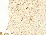 Phospho-ROCK2 (Tyr722) Antibody in Immunohistochemistry (Paraffin) (IHC (P))