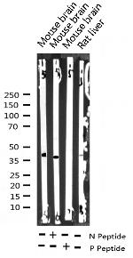 Phospho-EIF2S1 (Ser51) Antibody in Western Blot (WB)