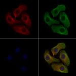 Phospho-IGF1R (Tyr1165, Tyr1166) Polyclonal Antibody