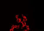 Phospho-IR/IGF1R (Tyr1161) Antibody in Immunocytochemistry (ICC/IF)