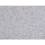 Phospho-IR/IGF1R (Tyr1161) Antibody in Immunohistochemistry (Paraffin) (IHC (P))