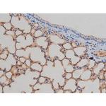 Phospho-IR/IGF1R (Tyr1161) Antibody in Immunohistochemistry (Paraffin) (IHC (P))