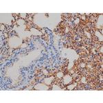 Phospho-IR/IGF1R (Tyr1161) Antibody in Immunohistochemistry (Paraffin) (IHC (P))