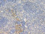 Phospho-IR/IGF1R (Tyr1161) Antibody in Immunohistochemistry (Paraffin) (IHC (P))