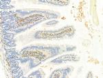 Phospho-IR/IGF1R (Tyr1161) Antibody in Immunohistochemistry (Paraffin) (IHC (P))