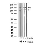 Phospho-IR/IGF1R (Tyr1161) Antibody in Western Blot (WB)