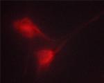 Phospho-BCR (Tyr360) Antibody in Immunocytochemistry (ICC/IF)