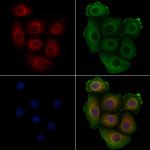 Phospho-BCR (Tyr360) Antibody in Immunocytochemistry (ICC/IF)