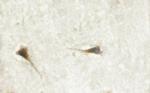 Phospho-BCR (Tyr360) Antibody in Immunohistochemistry (Paraffin) (IHC (P))
