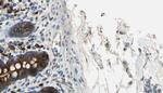 Phospho-BCR (Tyr360) Antibody in Immunohistochemistry (Paraffin) (IHC (P))