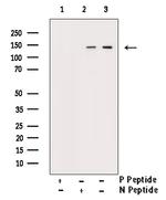 Phospho-BCR (Tyr360) Antibody in Western Blot (WB)