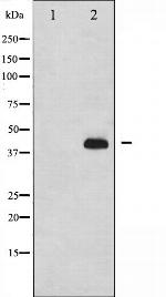 Phospho-p47phox (Ser359) Antibody in Western Blot (WB)