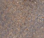 Phospho-PLCG2 (Tyr753) Polyclonal Antibody