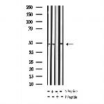 Phospho-Connexin 43 (Ser368) Antibody in Western Blot (WB)