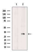 Phospho-Cyclin D1 (Ser90) Antibody in Western Blot (WB)