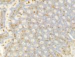 Phospho-PI3K p85/p55 (Tyr467, Tyr199) Antibody in Immunohistochemistry (Paraffin) (IHC (P))