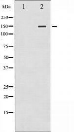 Phospho-iNOS (Tyr151) Antibody in Western Blot (WB)