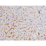 Phospho-IRS1 (Ser639) Antibody in Immunohistochemistry (Paraffin) (IHC (P))