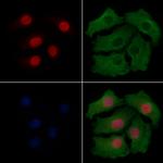 Phospho-CHOP (Ser30) Antibody in Immunocytochemistry (ICC/IF)